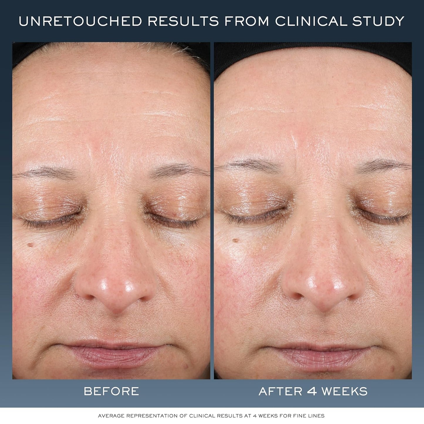 Lancôme Advanced Génifique Night Cream - Repairs Skin Barrier Overnight - With Bifidus Prebiotic, Hyaluronic Acid & Triple Ceramide Complex - 1.7 Fl Oz